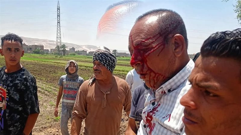 لحظة إصابة مدير حماية