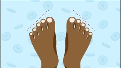 ما الذي تكشفه شكل القدمين عن شخصيتك؟ تحليل مثير يكشف الأمراض المحتملة  