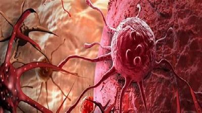 9 أطعمة طبيعية تقاوم الخلايا السرطانية وتعزز مناعة الجسم