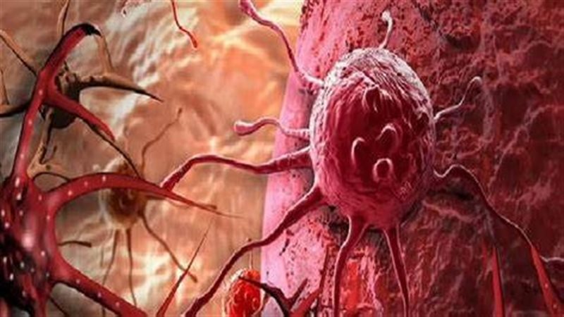 الخلايا السرطانية