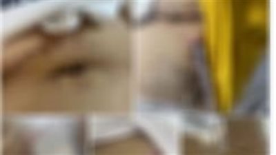 الأمن يوضح ملابسات التعدي بالأسلحة البيضاء على مواطن بالبحيرة