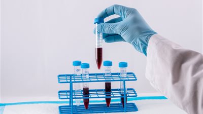 دراسة علمية: اختبار دم بسيط يكشف جودة الشيخوخة ويتنبأ بطول العمر