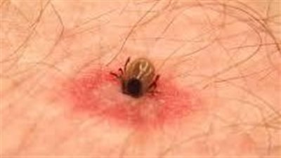 حشرة تهدد إسطنبول: 7002 حالة لدغة قراد منذ بداية العام