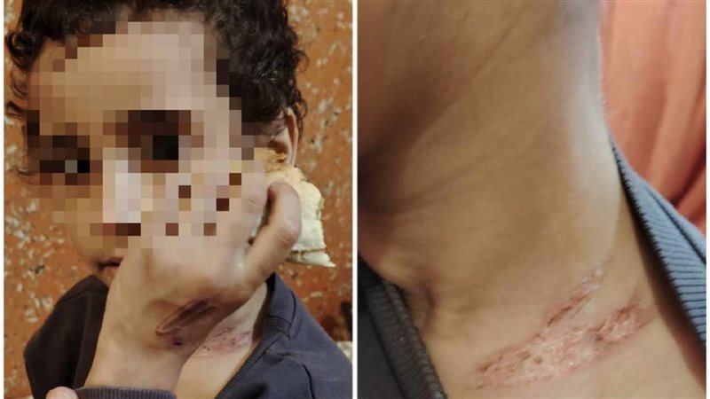 الطفلة فاطمة