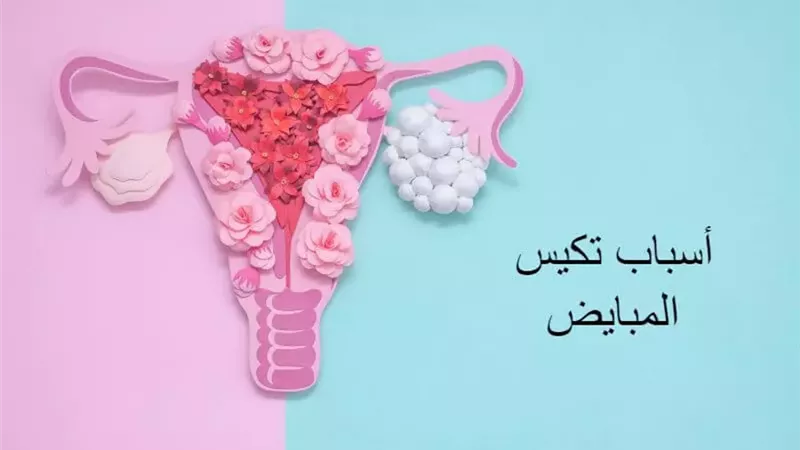 تكيس المبايض