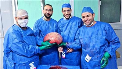 نجاح طبي جديد: استئصال ورم ضخم أنقذ حياة فتاة بمستشفى الفيوم العام
