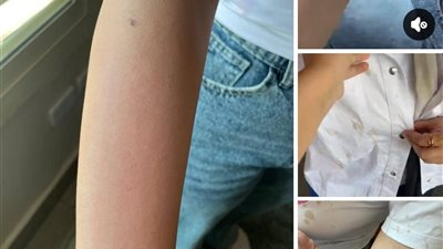 إصابات وحروق.. مشاجرة في إحدى كافيهات التجمع بسبب طلاب مدرسة إنترناشونال 