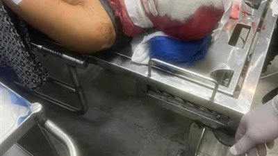 «أخويا هيروح مني».. استغاثة مؤثرة تكشف واقعة اعتداء بشعة في الشرقية