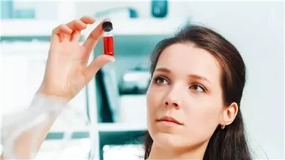 واحدة من كل ثلاث سيدات مصابة بالأنيميا في مصر..ماذا يعني ذلك؟