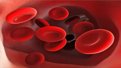 أعراض تشير إلى نقص الحديد في جسمك.. لا تتجاهلها                        