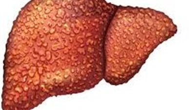 السكري يهدد الكبد.. علامات خطيرة يجب الانتباه لها        