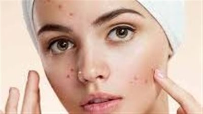 عادة يومية في المطبخ تسبب حب الشباب ومشاكل البشرة دون أن تدري