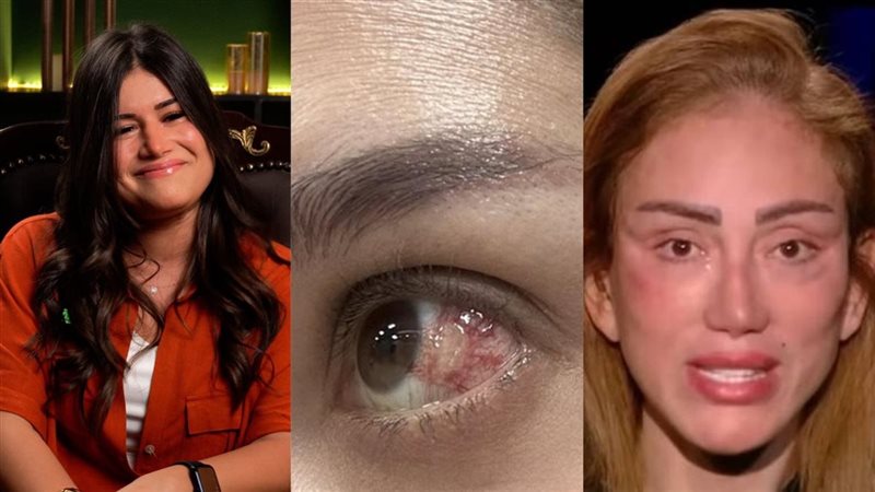 فنانات يقعن ضحية