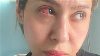بسبب خطاء طبي.. إيناس عز الدين تخضع لعملية جراحية عاجلة 