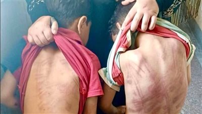  بسبب شاحن موبايل.. أب يُعذّب طفليه ضربًا بسلك كهرباء في حلوان