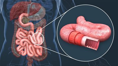 على الريق.. 5 مشروبات طبيعية تخلّص أمعاءك من السموم وتعيد لجسمك التوازن