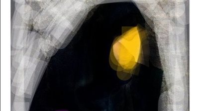 الدكتورة وفاء ياديس تقدم علاج نفسي مجاني للناجيات من حادث المنوفية