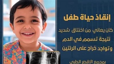 عملية جراحية دقيقة تنقذ حياة طفل بمجمع الأقصر الطبي