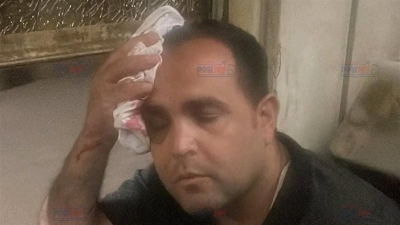 المواطن خلال الإصابة