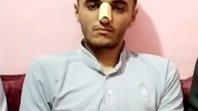 شاب من طنطا يفقد قدرته على السمع بعد دفاعه عن فتيات.. ووالده: ابني بقى عاجز