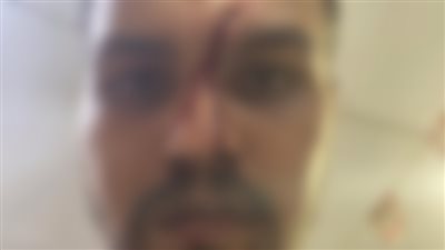 بسبب 5 جنيهات.. سائق ميكروباص يتعدى على راكب بسلاح أبيض فى البراجيل