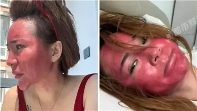 22 سنة مكياج من غير تنظيف.. النهاية كانت مأساوية لأمراة صينية