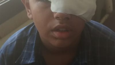 اعتداء مأساوي لطفل على زميله في الابتدائي بعد رفض التنمر عليه