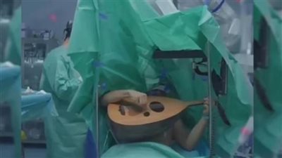 على أنغام أم كلثوم مطرب عراقي يعزف ويغني أثناء استئصال ورم من دماغه