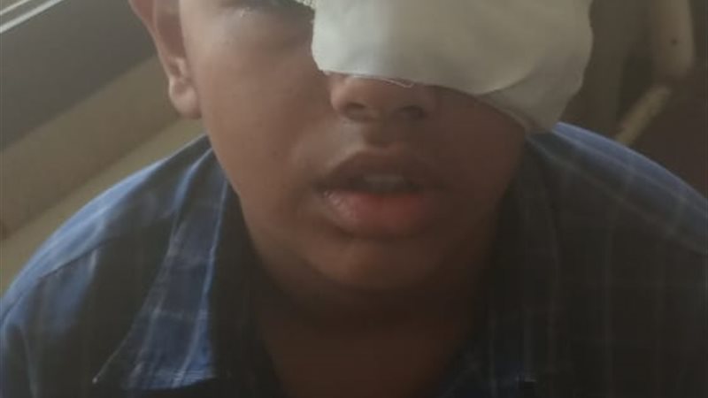 الطفل المجنى عليه