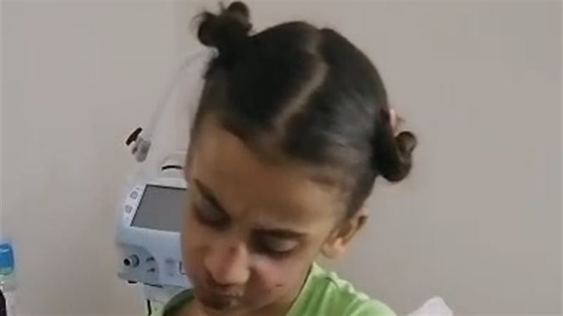 الأطفال ضحايا التغذيب