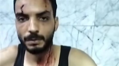 الاعتداء على شاب بسبب رفض بيع المخدرات بجوار منزله بمدينة نصر 