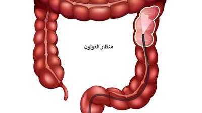 تشابه الأعراض قد يكون خادعًا: كيف تميّز بين الزائدة الدودية والقولون العصبي؟
