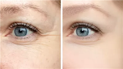 إعادة إنتاج الكولاجين.. سرّ البشرة الخالية من التجاعيد  