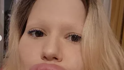 صاحبة أكبر شفاه في العالم تكشف عن شكلها قبل الجراحة التجميلية