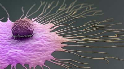 اختراق علمي واعد في علاج سرطان الثدي.. ماذا يعني للمرضى؟