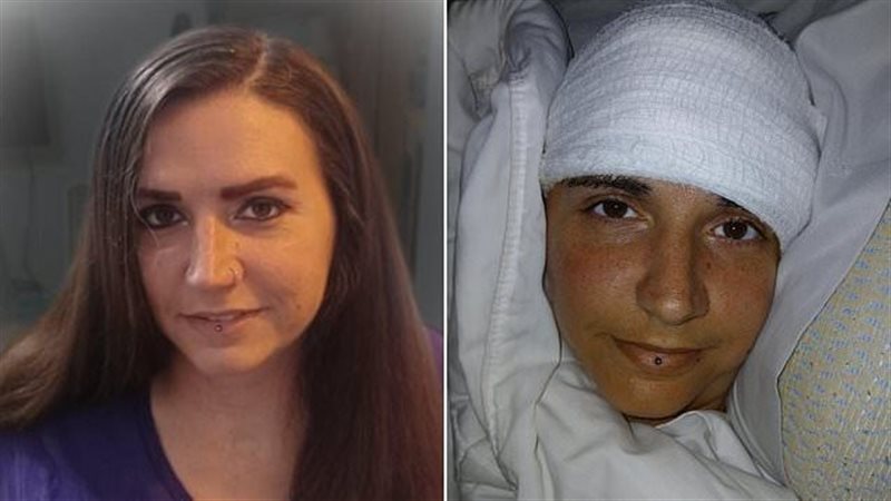 المرأة المشلولة