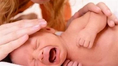 منفاخ الوجه والشعر الخشن.. قصة طفل رضيع ضحية الاستخدام الخاطئ لكريم بيتاديرم