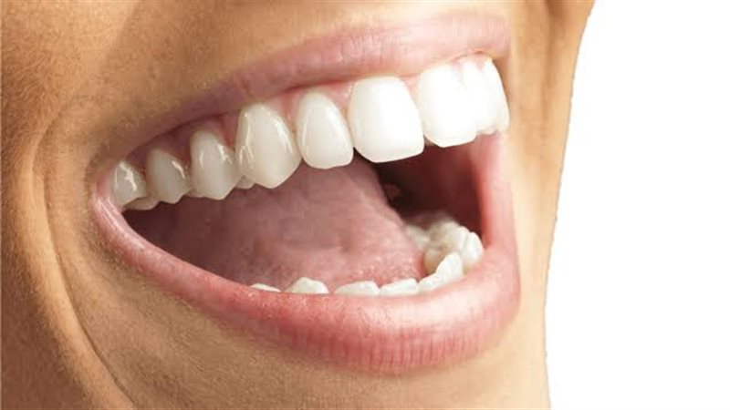 تعبيرية عن صحة الفم