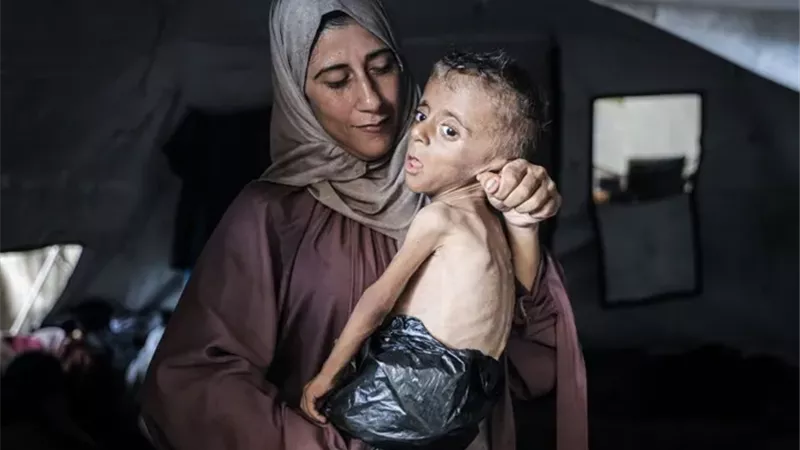 سكان غزة يعانون من