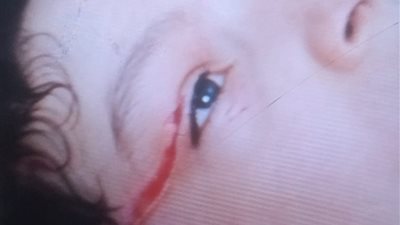 100 غرزة في جسد طفل وأم تفارق الحياة قهرا.. مأساة تهز المرج