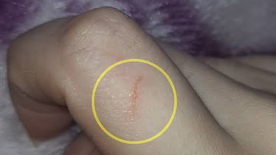 قطاع الطب الوقائي يحدّث الأدلة وضوابط الوقاية من مرض السعار