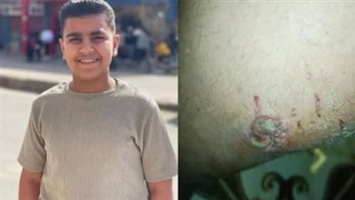 القبض على شخص أطلق كلب شرس على طفل من المصطافين ببورسعيد