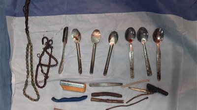 بلع ولاعات ومقصات.. جراحة معقدة تنقذ شابا بمستشفى سوهاج الجامعي