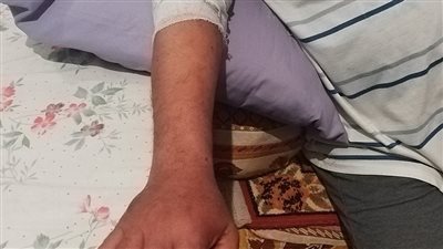 رئيس مدينة دشنا يفجر مفاجأة عن إصابته..«مكنتش في حملة إزالات كما أُشيع» (صور)