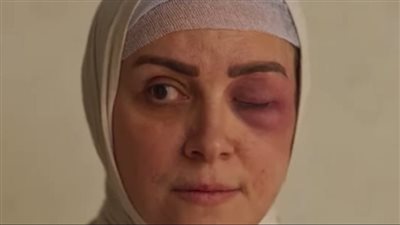 بعد اللجوء لها في ظلم المصطبة .. كل ما تريد معرفته عن «البشعة»