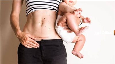 7 أكلات هتخليكي تقومي على رجلك بسرعة بعد الولادة القيصرية