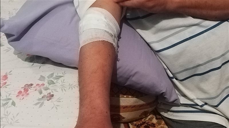 رئيس المدينة المصاب