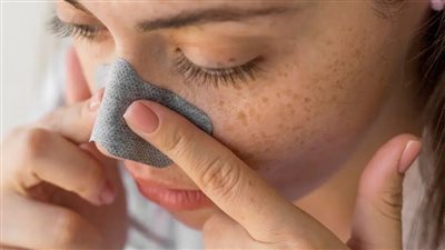 وصفات طبيعية للتخلص من الرؤوس البيضاء بطرق سهلة وآمنة