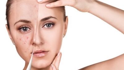 قبل العيد.. دليلك الشامل لتقشير البشرة وتنظيفها بدون أي ضرر