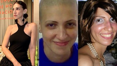 ياسمين يسري تكشف: هل يسبب العلاج الكيماوي شيخوخة مبكرة؟